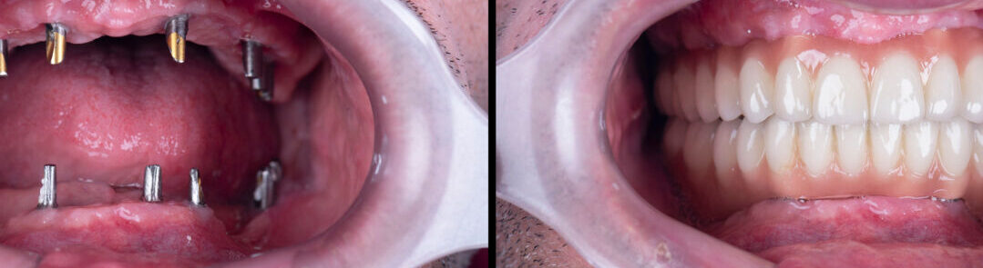 ANDHERI DENTAL CLINIC ANDHERI WEST